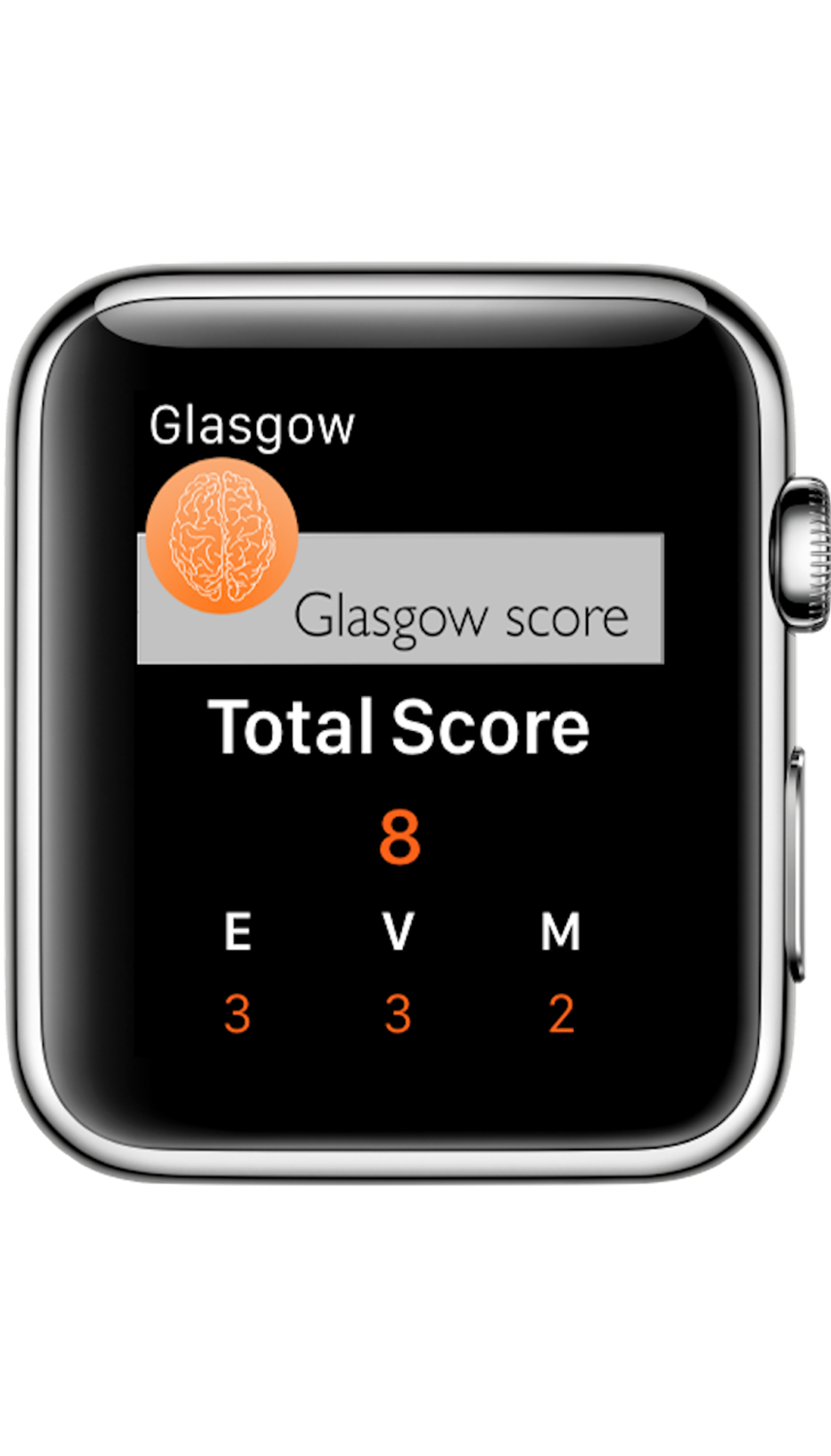 ...And also on Apple Watch!